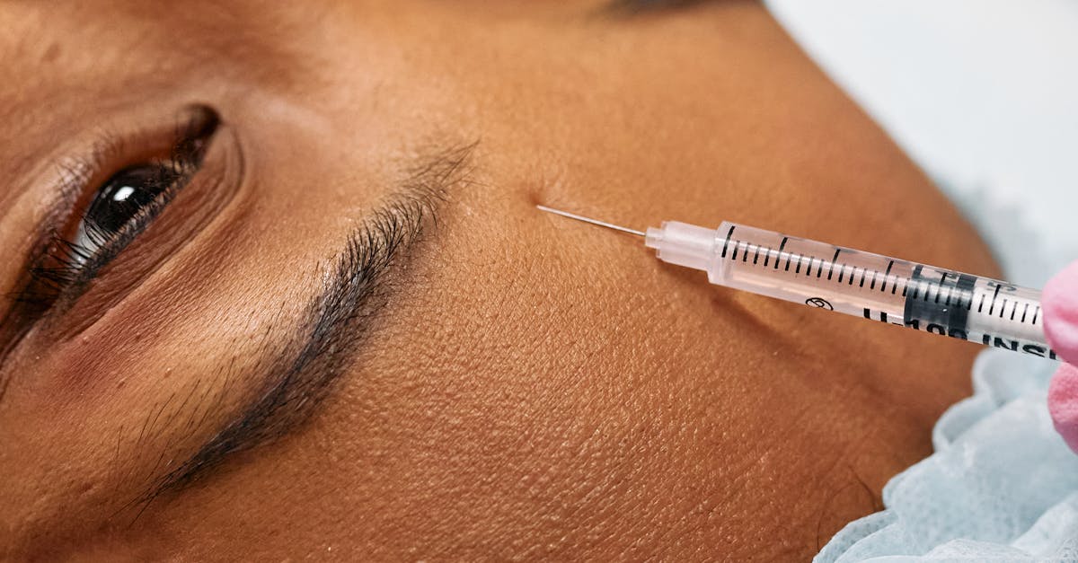 Comparing Duration: Botox vs. Other Cosmetic Treatments