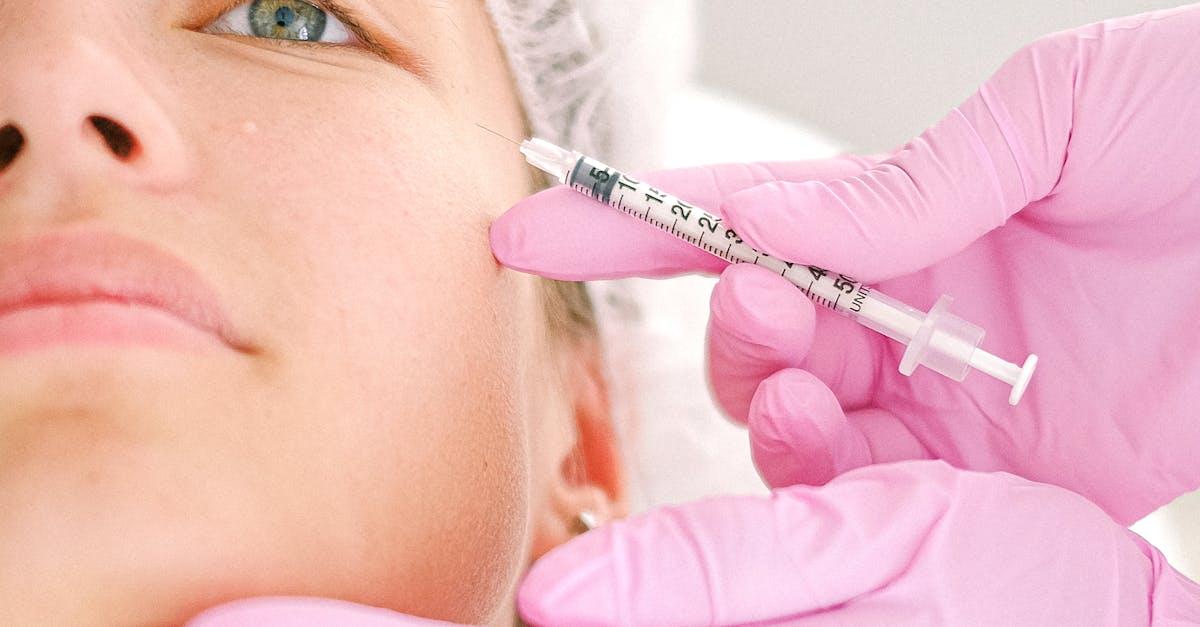 How to Prepare for Your Botox Consultation